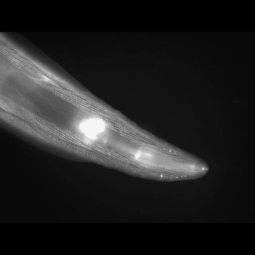  NCBI Organism:Caenorhabditis elegans; Cell Types:muscle cell Cell Components:actin filament Biological process:chronological cell aging