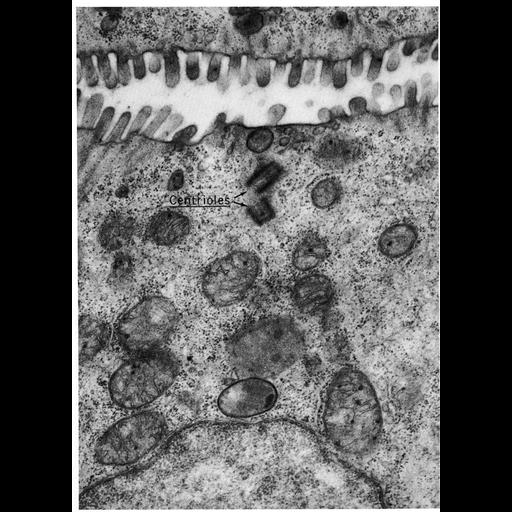  NCBI Organism:Gallus gallus; Cell Types:epithelial cell, ; Cell Components:centriole, , microvillus, cytoplasm; Biological process:cytoplasm organization, intercellular bridge organization;