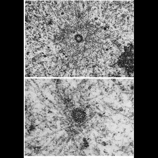  NCBI Organism:Potorous tridactylus; Cell Components:centriole, pericentriolar material; Biological process:centriole replication, spindle organization;