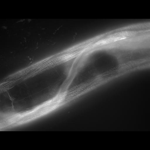  NCBI Organism:Caenorhabditis elegans; Cell Types:muscle cell Cell Components:actin filament Biological process:chronological cell aging