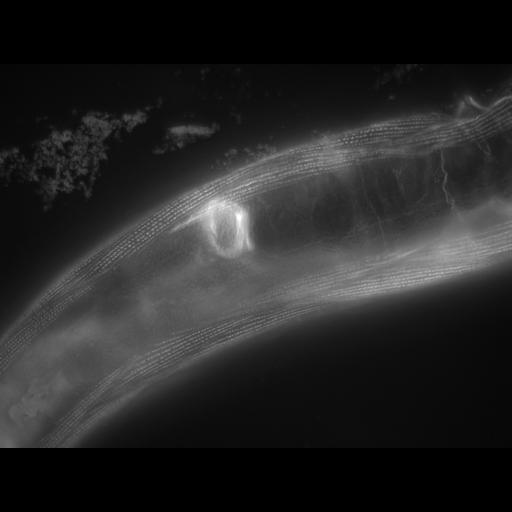  NCBI Organism:Caenorhabditis elegans; Cell Types:muscle cell Cell Components:actin filament Biological process:chronological cell aging