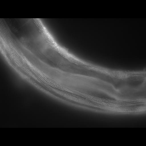  NCBI Organism:Caenorhabditis elegans; Cell Types:muscle cell Cell Components:actin filament Biological process:chronological cell aging