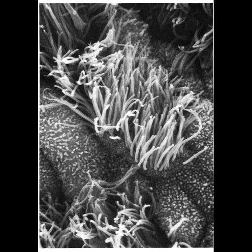  NCBI Organism:Homo sapiens; Cell Types:ciliated epithelial cell, ; Cell Components:cilium, microvillus; Biological process:, microvillus organization;