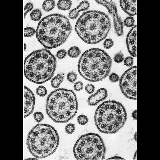  NCBI Organism:Rattus sp.; Cell Types:tracheal epithelial cell Cell Components:cilium, axoneme, microvillus; Biological process:epithelial cilium movement, cilium axoneme assembly;