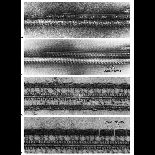  NCBI Organism:Tetrahymena sp. SPE01, Elliptio crassidens, ; Cell Types:ciliated cell, ciliated epithelial cell; Cell Components:cilium, axoneme, axonemal microtubule, axonemal dynein complex; Biological process:ciliary or flagellar motility, cilium movement, epithelial cilium movement;