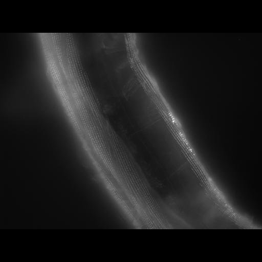  NCBI Organism:Caenorhabditis elegans; Cell Types:muscle cell Cell Components:actin filament Biological process:chronological cell aging