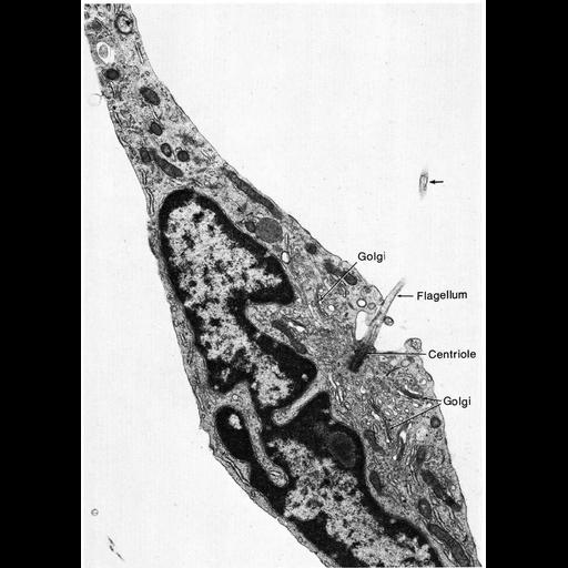  NCBI Organism:Rattus sp.; Cell Types:mesenchymal cell, ; Cell Components:cilium, axoneme, nucleus, cytoplasm; Biological process:, microtubule basal body organization;