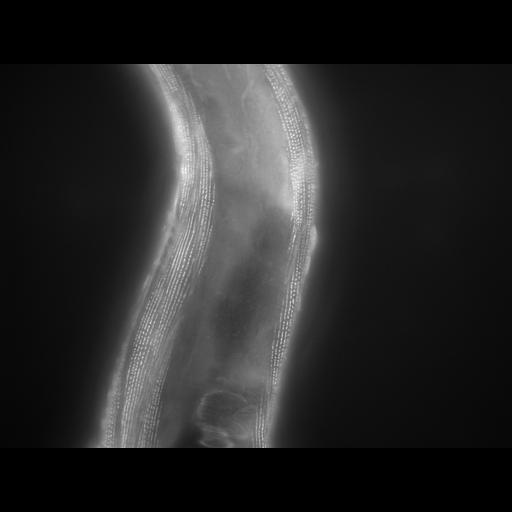  NCBI Organism:Caenorhabditis elegans; Cell Types:muscle cell Cell Components:actin filament Biological process:chronological cell aging