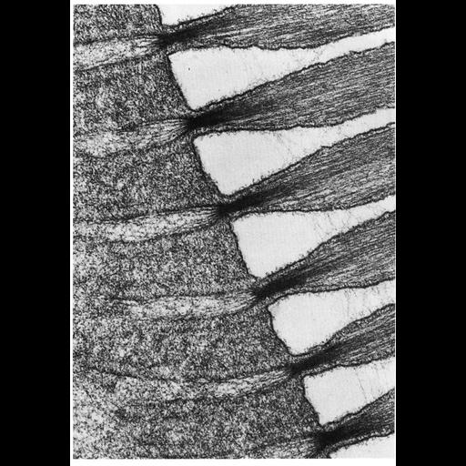  NCBI Organism:Carassius sp. U8MN; Cell Components:stereocilium Biological process:, auditory receptor cell stereocilium organization;