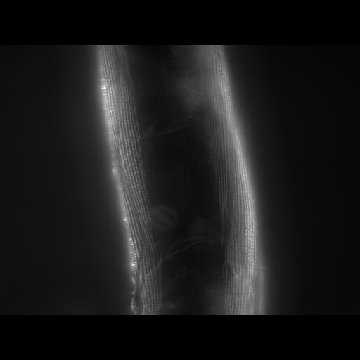  NCBI Organism:Caenorhabditis elegans; Cell Types:muscle cell Cell Components:actin filament Biological process:chronological cell aging