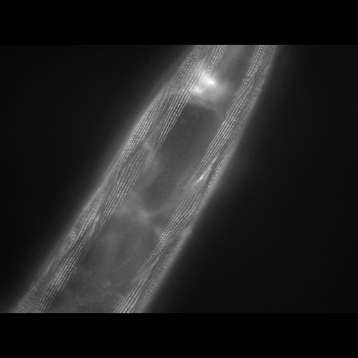  NCBI Organism:Caenorhabditis elegans; Cell Types:muscle cell Cell Components:actin filament Biological process:chronological cell aging