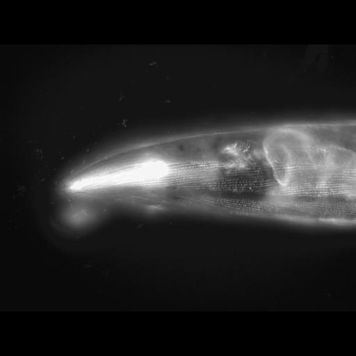  NCBI Organism:Caenorhabditis elegans; Cell Types:muscle cell Cell Components:actin filament Biological process:chronological cell aging