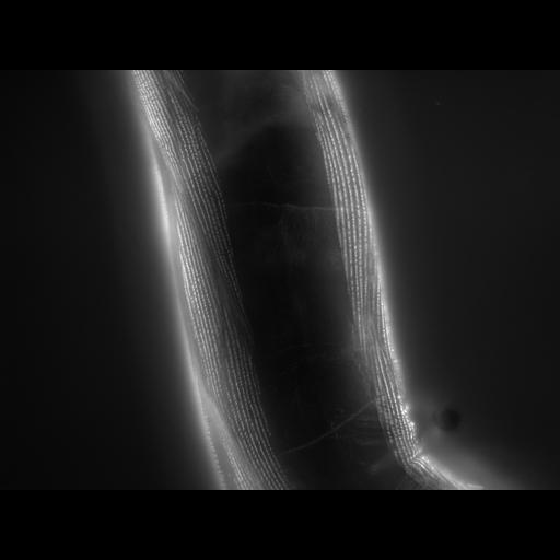  NCBI Organism:Caenorhabditis elegans; Cell Types:muscle cell Cell Components:actin filament Biological process:chronological cell aging