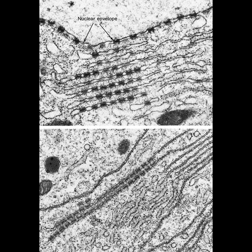  NCBI Organism:Arbacia; Cell Types:oocyte Cell Components:annulate lamellae, nuclear envelope, nuclear pore, endoplasmic reticulum; Biological process:nucleus organization, nuclear pore organization;