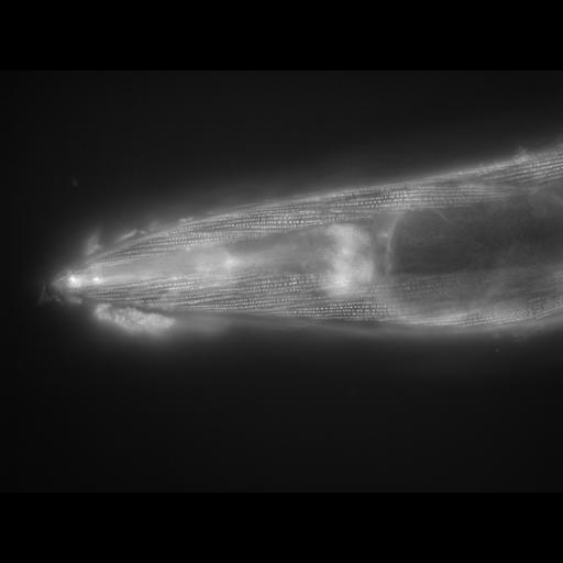  NCBI Organism:Caenorhabditis elegans; Cell Types:muscle cell Cell Components:actin filament Biological process:chronological cell aging