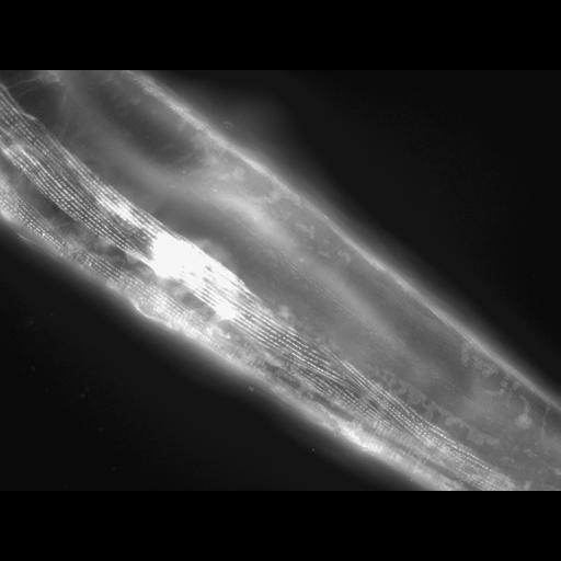  NCBI Organism:Caenorhabditis elegans; Cell Types:muscle cell Cell Components:actin filament Biological process:chronological cell aging