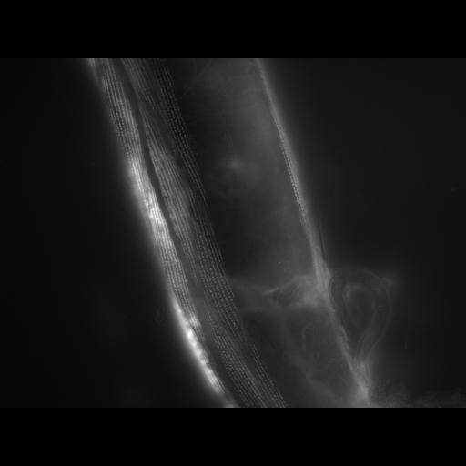  NCBI Organism:Caenorhabditis elegans; Cell Types:muscle cell Cell Components:actin filament Biological process:chronological cell aging