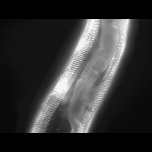  NCBI Organism:Caenorhabditis elegans; Cell Types:muscle cell Cell Components:actin filament Biological process:chronological cell aging