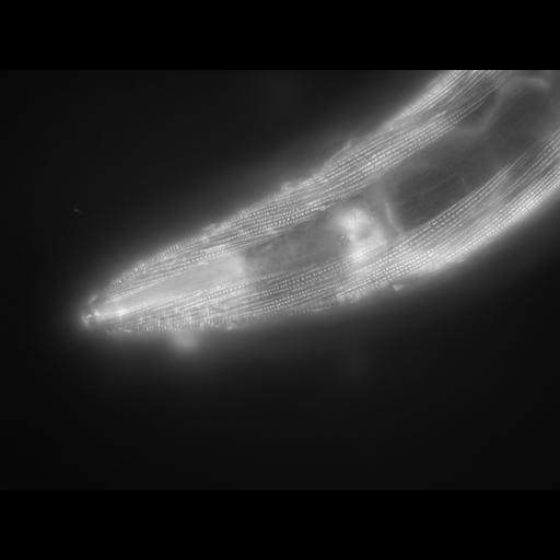  NCBI Organism:Caenorhabditis elegans; Cell Types:muscle cell Cell Components:actin filament Biological process:chronological cell aging