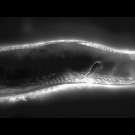  NCBI Organism:Caenorhabditis elegans; Cell Types:muscle cell Cell Components:actin filament Biological process:chronological cell aging