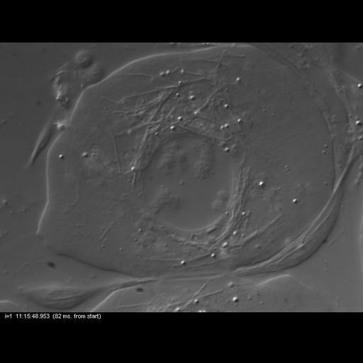  NCBI Organism:Nephrotoma, , ; Cell Types:primary spermatocyte Cell Components:spindle, nuclear chromosome; Biological process:male meiosis chromosome segregation