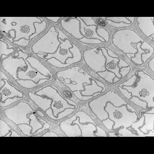  NCBI Organism:Paramecium multimicronucleatum; Cell Types:cell by organism, eukaryotic cell, , ; Cell Components:plasma membrane, axoneme, cell cortex, ; Biological process:cortical cytoskeleton organization, ciliary or flagellar motility, plasma membrane organization;