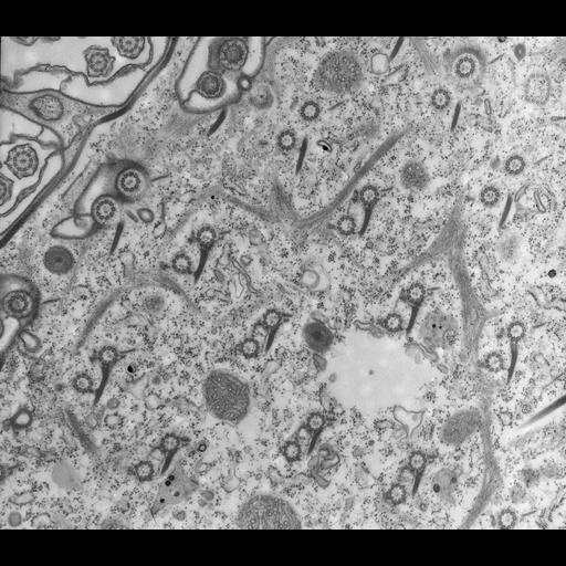  NCBI Organism:Paramecium multimicronucleatum; Cell Types:cell by organism, eukaryotic cell, , ; Cell Components:cell cortex, microtubule basal body, trichocyst, microtubule, , ; Biological process:cortical cytoskeleton organization, microtubule basal body organization, microtubule cytoskeleton organization;