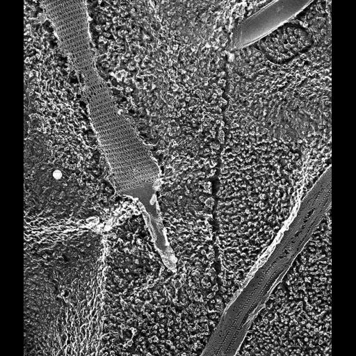  NCBI Organism:Paramecium multimicronucleatum; Cell Types:cell by organism, eukaryotic cell, , ; Cell Components:cilium, cilium axoneme, axonemal dynein complex, trichocyst; Biological process:axonemal dynein complex assembly, ;