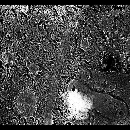  NCBI Organism:Paramecium multimicronucleatum; Cell Types:cell by organism, eukaryotic cell, , ; Cell Components:axonemal dynein complex, cilium axoneme, axonemal microtubule; Biological process:axonemal dynein complex assembly, cilium axoneme assembly, microtubule-based movement;