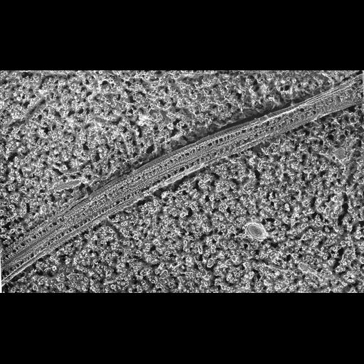  NCBI Organism:Paramecium multimicronucleatum; Cell Types:cell by organism, eukaryotic cell, , ; Cell Components:radial spoke, cilium axoneme, axonemal microtubule; Biological process:cilium movement, cilium axoneme assembly, ciliary or flagellar motility, axoneme assembly;