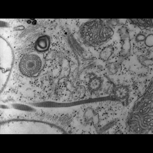  NCBI Organism:Paramecium multimicronucleatum; Cell Types:cell by organism, eukaryotic cell, , ; Cell Components:cortical cytoskeleton, cell cortex, microtubule basal body, microtubule; Biological process:cortical cytoskeleton organization, microtubule basal body organization, microtubule cytoskeleton organization, ;