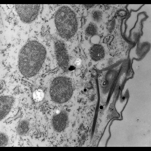  NCBI Organism:Paramecium multimicronucleatum; Cell Types:cell by organism, eukaryotic cell, , ; Cell Components:cell cortex, microtubule basal body, microtubule, coated pit, ; Biological process:cortical cytoskeleton organization