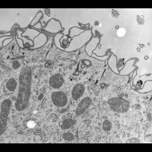  NCBI Organism:Paramecium multimicronucleatum; Cell Types:cell by organism, eukaryotic cell, , ;