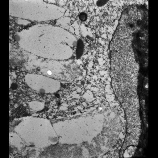  NCBI Organism:Paramecium tetraurelia; Cell Types:cell by organism, eukaryotic cell, , ; Cell Components:micronucleus, nuclear envelope, ; Biological process:micronucleus organization, nuclear division, ;