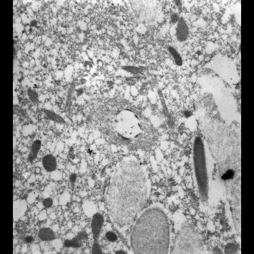  NCBI Organism:Paramecium tetraurelia; Cell Types:cell by organism, eukaryotic cell, , ; Cell Components:contractile vacuole, contractile vacuolar membrane, cytoplasmic microtubule; Biological process:contractile vacuole organization, cytoplasm organization;