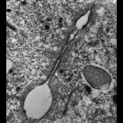  NCBI Organism:Paramecium tetraurelia; Cell Types:cell by organism, eukaryotic cell, , ; Cell Components:contractile vacuole, contractile vacuolar membrane, cytoplasmic microtubule; Biological process:microtubule cytoskeleton organization, contractile vacuole organization;