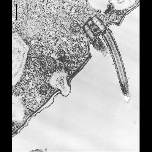  NCBI Organism:Colpoda cucullus; Cell Types:cell by organism, eukaryotic cell, , ; Cell Components:cilium, axoneme, microtubule basal body, , cell cortex; Biological process:cell motility