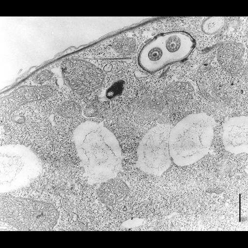  NCBI Organism:Colpoda cucullus; Cell Types:cell by organism, eukaryotic cell, , ; Cell Components:cilium, axoneme, cell cortex, , cytoplasm; Biological process:cell motility, cortical cytoskeleton organization, cytoplasm organization;