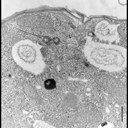  NCBI Organism:Colpoda cucullus; Cell Types:cell by organism, eukaryotic cell, , ; Cell Components:cilium, axoneme, microtubule basal body, , , cell cortex; Biological process:cell motility, cortical cytoskeleton organization;