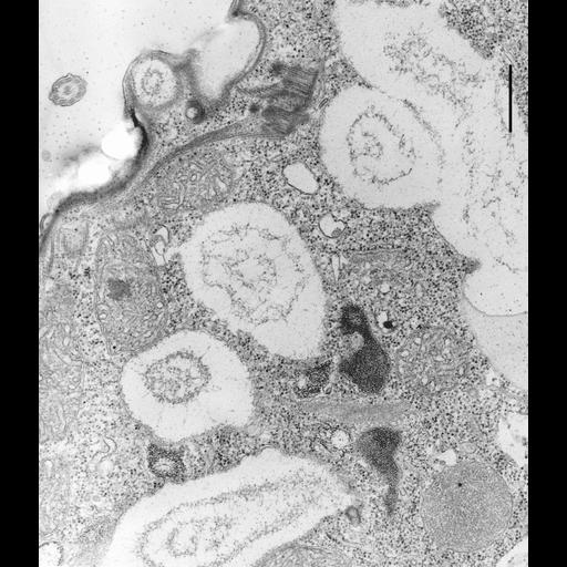  NCBI Organism:Colpoda cucullus; Cell Types:cell by organism, eukaryotic cell, , ; Cell Components:cilium, axoneme, microtubule basal body, , cell cortex, peroxisome; Biological process:cell motility, cortical cytoskeleton organization;