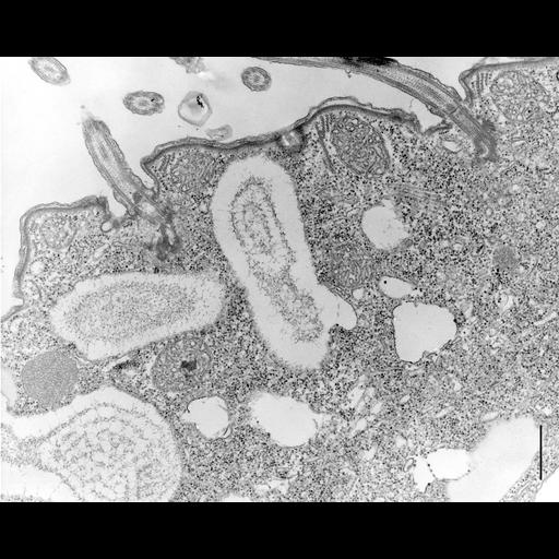  NCBI Organism:Colpoda cucullus; Cell Types:cell by organism, eukaryotic cell, , ; Cell Components:cilium, axoneme, microtubule basal body, , , cell cortex; Biological process:cell motility, cortical cytoskeleton organization;