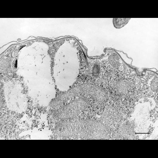  NCBI Organism:Colpoda cucullus; Cell Types:cell by organism, eukaryotic cell, , ; Cell Components:cell cortex, microtubule basal body, , ; Biological process:cortical cytoskeleton organization, cortical protein anchoring;