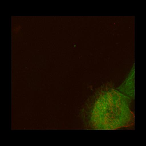  NCBI Organism:Homo sapiens; Cell Types:epithelial cell Cell Components:microtubule, cell cortex part; Biological process:cell-substrate adhesion, epithelial cell migration, establishment or maintenance of apical/basal cell polarity, cell division;