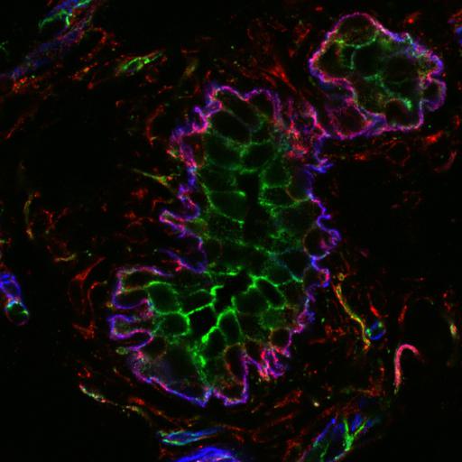  NCBI Organism:Mus musculus; Cell Types:epithelial cell Cell Components:microtubule, basal cortex, lateral plasma membrane; Biological process:cell-substrate adhesion, epithelial cell migration, establishment or maintenance of apical/basal cell polarity, cell division;