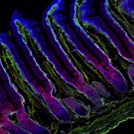  NCBI Organism:Mus musculus; Cell Types:epithelial cell Cell Components:microtubule, basal cortex, microvillus, basement membrane; Biological process:cell-substrate adhesion, epithelial cell migration, establishment or maintenance of apical/basal cell polarity, cell division;