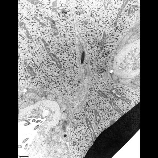  NCBI Organism:Didinium nasutum; Cell Types:cell by organism, eukaryotic cell, , ; Cell Components:cell division site, cleavage furrow, , , nucleolar chromatin; Biological process:, cortical microtubule organization, nuclear division, , ;