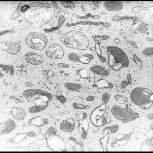  NCBI Organism:Nassula; Cell Types:cell by organism, eukaryotic cell, , ; Cell Components:cytoplasm, vesicle membrane; Biological process:cytoplasm organization, ;