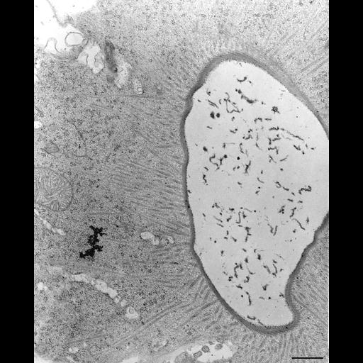  NCBI Organism:Nassula; Cell Types:cell by organism, eukaryotic cell, , ; Cell Components:contractile vacuole pore, microtubule associated complex, cytoplasm; Biological process:, microtubule cytoskeleton organization, cytoplasm organization;