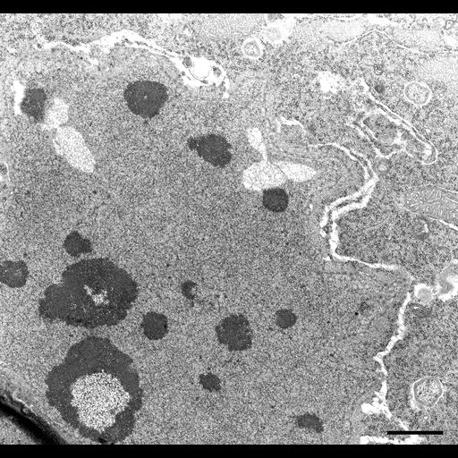  NCBI Organism:Nassula; Cell Types:cell by organism, eukaryotic cell, , ; Cell Components:macronucleus, nucleolus, nucleolar part; Biological process:macronucleus organization, nucleolus organization;