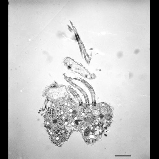  NCBI Organism:Halteria grandinella; Cell Types:cell by organism, eukaryotic cell, , ; Cell Components:oral apparatus, contractile vacuole; Biological process:oral apparatus organization, contractile vacuole organization, cytoplasm organization;